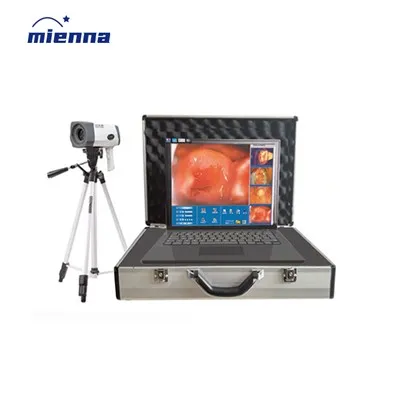 سرجیکل گائناکالوجی ڈیجیٹل الیکٹرانک کولپوسکوپ